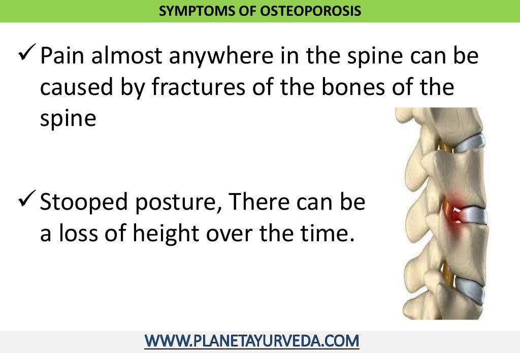 Ayurvedic treatment of osteoporosis