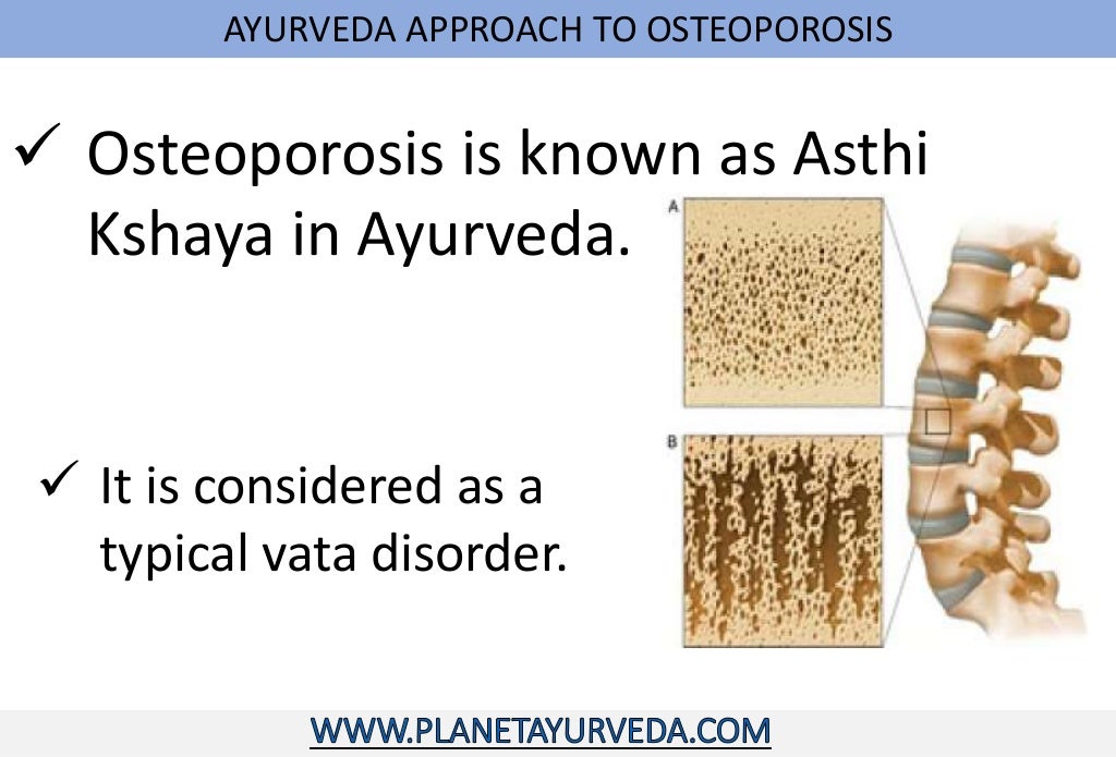 Ayurvedic treatment of osteoporosis
