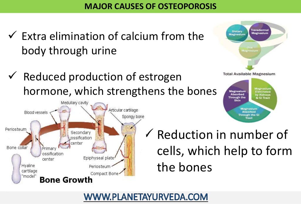 Ayurvedic treatment of osteoporosis