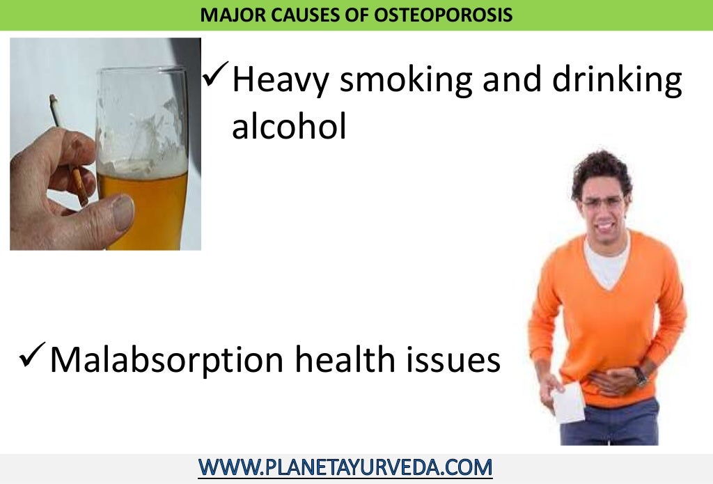 Ayurvedic treatment of osteoporosis