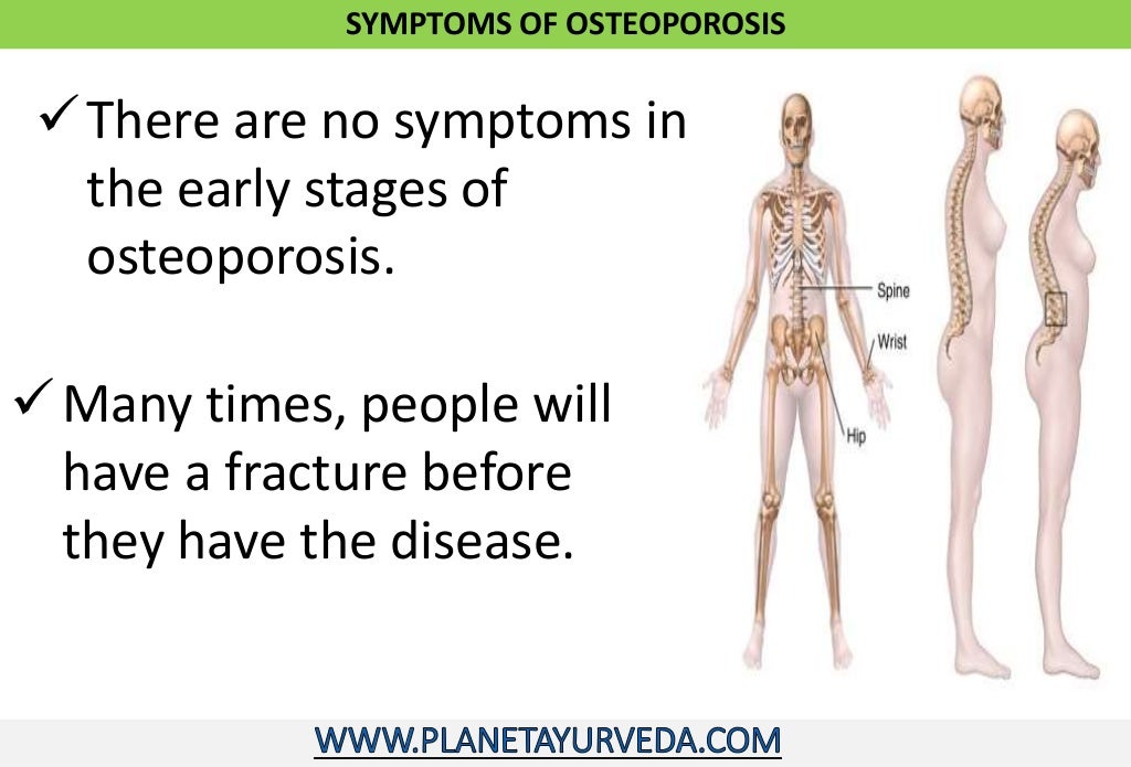 Ayurvedic treatment of osteoporosis