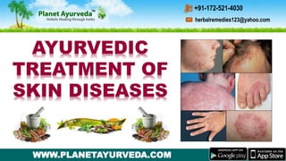 WWW.PLANETAYURVEDA.COM
AYURVEDIC
TREATMENT OF
SKIN DISEASES
herbalremedies123@yahoo.com
+91-172-521-4030
 