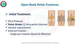 Mansoura Annual Orthopedic Surgery Department Conference - October 2019
Open Book Pelvic Fractures
 Initial Treatment:
 ATLS Protocol
 Pelvic Binder ( Intra-pelvic Volume)
 Volume replacement
 External Fixation :
- Single pin Fixation (Quick & Effective)
 