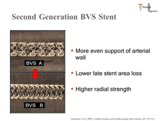 Second Generation BVS Stent More even support of arterial wall Lower late stent area loss Higher radial strength Ormiston et al. (2007). Catheterization and Cardiovascular Intervention, 69: 129-131 
