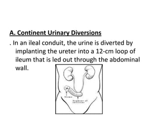 A. Continent Urinary Diversions
. In an ileal conduit, the urine is diverted by
implanting the ureter into a 12-cm loop of
ileum that is led out through the abdominal
wall.

 