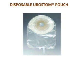 DISPOSABLE UROSTOMY POUCH

 