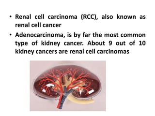 • Renal cell carcinoma (RCC), also known as
renal cell cancer
• Adenocarcinoma, is by far the most common
type of kidney cancer. About 9 out of 10
kidney cancers are renal cell carcinomas

 