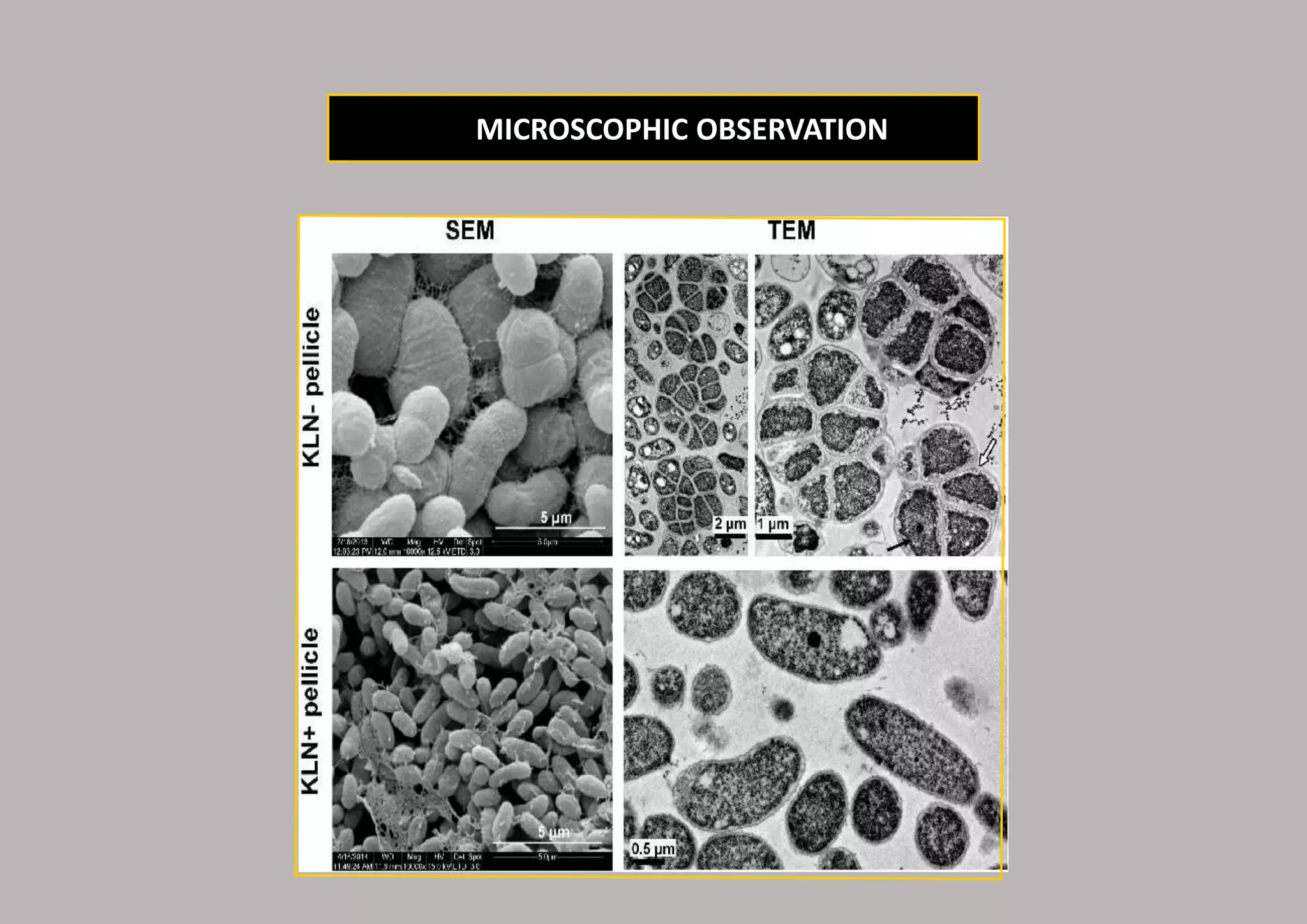 MICROSCOPHIC OBSERVATION
 