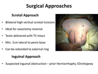Surgical Approaches
Scrotal Approach
• Bilateral high vertical scrotal incisions
• Ideal for vasectomy reversal
• Testis delivered with TV intact
• Min. 1cm lateral to penis-base
• Can be extended to external ring
Inguinal Approach
• Suspected inguinal obstruction – prior Herniorrhaphy /Orchiopexy
 