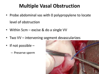 Multiple Vasal Obstruction
• Probe abdominal vas with 0 polypropylene to locate
level of obstruction
• Within 5cm – excise & do a single VV
• Two VV – intervening segment devascularizes
• If not possible –
– Preserve sperm
 