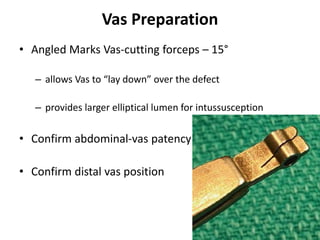 Vas Preparation
• Angled Marks Vas-cutting forceps – 15°
– allows Vas to “lay down” over the defect
– provides larger elliptical lumen for intussusception
• Confirm abdominal-vas patency
• Confirm distal vas position
 