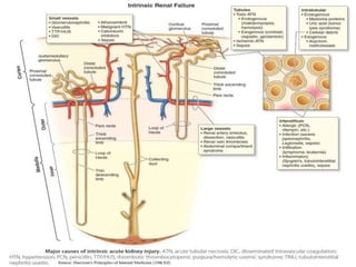azotemia.pptx