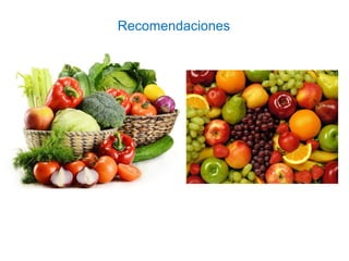Recomendaciones
 