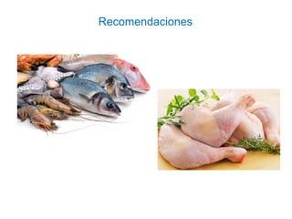 Recomendaciones
 