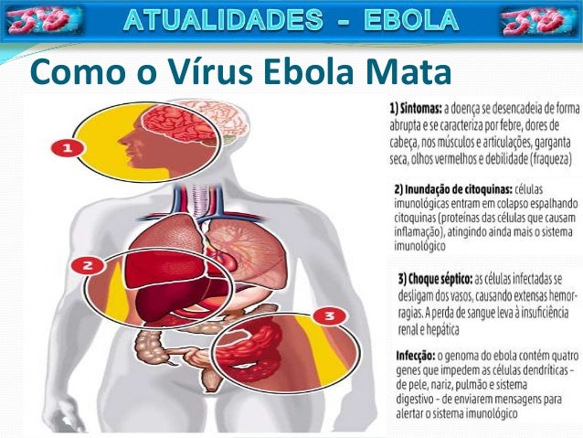 Resultado de imagem para EBOLA