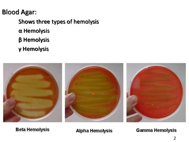 test blood sugar 4.2 B.Sc. Microbiology Media Unit II 4.2 Culture Bacteriology