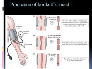 Production of kortkoff’s sound
 