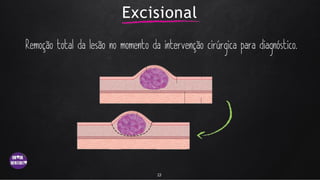 Excisional
13
 