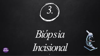 3.
Biópsia
Incisional
9
 