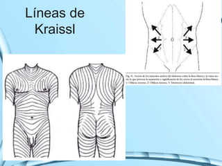 Líneas de
Kraissl
 