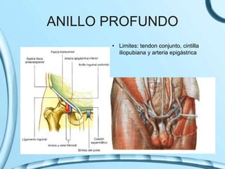 ANILLO PROFUNDO
• Limites: tendon conjunto, cintilla
iliopubiana y arteria epigástrica
 