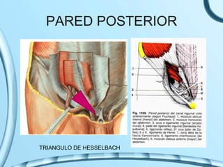PARED POSTERIOR
TRIANGULO DE HESSELBACH
 