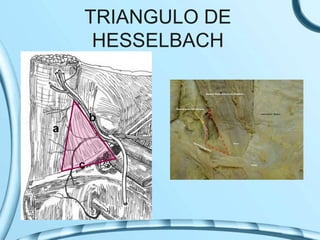 TRIANGULO DE
HESSELBACH
 