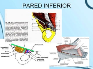 PARED INFERIOR
 