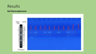 Results
Gel Electrophoresis
 