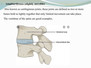 2. Amphiarthroses (slightly movable)
Also known as cartilaginous joints, these joints are defined as two or more
bones held so tightly together that only limited movement can take place.
The vertebrae of the spine are good examples.
 