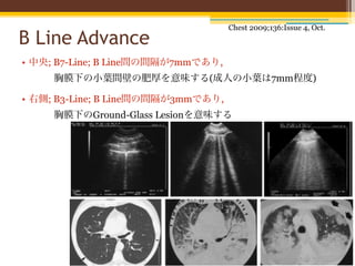 Chest 2009;136:Issue 4, Oct.
B Line Advance
• 中央; B7-Line; B Line間の間隔が7mmであり,
     胸膜下の小葉間壁の肥厚を意味する(成人の小葉は7mm程度)

• 右側; B3-Line; B Line間の間隔が3mmであり,
     胸膜下のGround-Glass Lesionを意味する
 