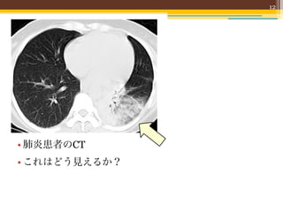 12




• 肺炎患者のCT
• これはどう見えるか？
 