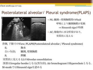 Chest 2008;134:117-125


 Posterolateral alveolar/ Pleural syndrome(PLAPS)
                                    • PE; 臓側―壁側胸膜間のFluid
                                           呼吸により臓側胸膜が変動
                                            ⇒ Sinusoid signが特徴
                                    • AC; 肺胞内に水分貯留があり,
                                           実質状に見える


 背側, 下肺でのView; PLAPS(Posterolateral alveolar / Pleural syndrome)
  E;                 胸水
  白い矢印;              臓側, 壁側胸膜
  S;                 脾臓
  実質状に見える LLがAlveolar consolidation
  深部はIrregular borderとなる(黒矢印). Air bronchogramはHyperechoicとなる.
 M-modeではSinusoid signを認める
 
