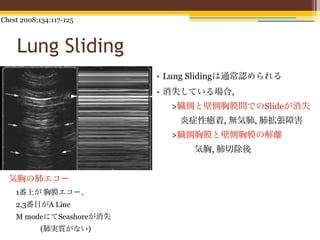 Chest 2008;134:117-125



    Lung Sliding
                         • Lung Slidingは通常認められる
                         • 消失している場合,
                           >臓側と壁側胸膜間でのSlideが消失
                            炎症性癒着, 無気肺, 肺拡張障害
                           >臓側胸膜と壁側胸膜の解離
                               気胸, 肺切除後


  気胸の肺エコー
   1番上が 胸膜エコー、
   2,3番目がA Line
   M modeにてSeashoreが消失
           (肺実質がない)
 