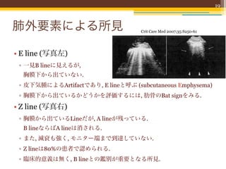 (Fig. 6). Diffuse lung rockets dissemi-              pedes ultrasound). The detect
                                                    nated all over the anterolateral wall de-            are smaller than the resoluti
                                                                                                                                19
                                                    ﬁne diffuse interstitial syndrome. The               sound. They are present at a
                                                    test is deﬁned as negative when such B               the lung surface. They are sep
                                                    lines are absent, isolated, or exclusively           each other by Յ7 mm. They
   肺外要素による所見                                                                         Crit Care Med 2007;35:S250-61




    • E line (写真左)
Figure 6. Interstitial syndrome. These vertical
        ▫ 一見B lineに見えるが,
comet-tail artifacts have the speciﬁc peculiarities
of strictly arising from the pleural line, being
           胸膜下から出ていない.
well-deﬁned and laser-like, moving with the lung
sliding, spreading to the edge of the screen with- Figure 7. Some artifacts: E and Z lines. Left, these well-deﬁned comet tails descend to t
        ▫ 皮下気腫によるArtifactであり, E lineと呼ぶ (subcutaneous Emphysema)
out fading, and erasing normal A lines. This pat- screen. However, the bat sign is absent (as with Fig. 6). This pattern cannot be due t
tern deﬁnes B lines. Several B lines in a single patient has subcutaneous emphysema with extensive collections of gas between an
        ▫ 胸膜下から出ているかどうかを評価するには, 肋骨のBat signをみる.
view deﬁne lung rockets. Diffuse lung rockets tures—a condition generating E lines. Right, the ill-deﬁned comet-tail artifacts (thre
indicate interstitial syndrome. This patient has arrowheads) arise from the pleural line but do not erase the physiologic A lines (arrow
    • Z line (写真右)
cardiogenic pulmonary edema.                        vanish without reaching the edge of the screen. These are Z lines.


        ▫ 胸膜から出ているLineだが,
Crit Care Med 2007 Vol. 35, No. 5 (Suppl.)              A lineが残っている.
          B lineならばA lineは消される.
       ▫ また, 減衰も強く, モニター端まで到達していない.
       ▫ Z lineは80%の患者で認められる.
       ▫ 臨床的意義は無く, B lineとの鑑別が重要となる所見.
 