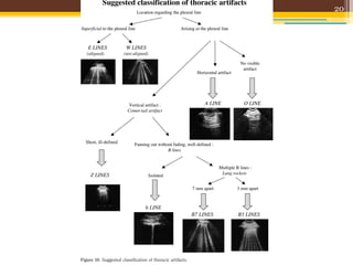 artifacts that do not provide di
                                                            information.            20
                                                            DISCUSSION
                                                                As an air-ﬁlled structure, the
                                                            an organ for which ultrasound tr
                                                            ally had a limited diagnostic v
                                                            fact, lung ultrasound is hardly s
                                                            to exist (23). Yet the use of bas
                                                            makes immediate management
                                                            threatening conditions possible
                                                            cessible with simple units, lun
                                                            sound could have been develop
                                                            the advent of real-time ultrasou
                                                            ﬁrst observations were made usi
                                                            technology (ADR-4000). In addit
                                                            small size of these devices mad
                                                            fully suitable for the ICU and th
                                                            gency department.
                                                                In the literature, we discover,
                                                            ingly, that horses have already b
                                                            from ultrasound— because the
                                                            ment of the lung toward the ches
                                                            visible (24). Human studies follo
                                                            their impact was minimal. In fac
                                                            knowledge, studies have suffer
                                                            various shortcomings.
                                                                Sistrom et al. (25) looked at
                                                            sitivity of lung sliding and come
                                                            13 patients with radiologic pneu
                                                            rax occurring after chest biops
                                                            7-MHz linear probes in units ha
                                                            sonologists (i.e., nonphysicians
                                                            quently supervised by radiologis
                                                            study demonstrated moderate acc
                                                            ultrasound with 73% sensitivi
                                                            speciﬁcity, 89% negative predicti
                                                            and 40% positive predictive val
                                                            can such results be explained? F
                                                            trasound gives its best, in our
Figure 10. Suggested classiﬁcation of thoracic artifacts.   when used by only one and sam
 