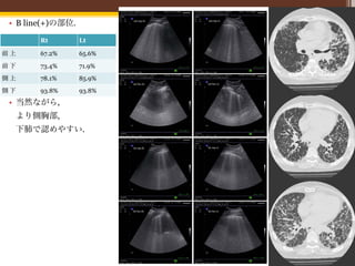 31
• B line(+)の部位.

       Rt         Lt

前上     67.2%      65.6%

前下     73.4%      71.9%
側上     78.1%      85.9%
側下     93.8%      93.8%
• 当然ながら,
 より側胸部,
 下肺で認めやすい.
 