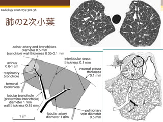approximately 0.5 mm in diameter. trees; lobules do not arise at a speciﬁc
                             Veins can sometimes be seen as linear, branching generation or from a speciﬁc  4
 Radiology 2006;239:322-38 arcuate, or branching structures 1.0 –         type of bronchiole or artery (8).
                             1.5 cm from the pleural surface or sur-          Branching of the lobular bronchiole
                             rounding centrilobular arteries and ap- and artery is irregularly dichotomous
    肺の2次小葉
h of 1-mm lung slice taken
                             proximately 5–10 mm from the arteries. (10). Most often, bronchioles and arter-
                             Pulmonary veins may also be identiﬁed ies divide into two branches of different
 be. Two well-deﬁned sec-    by their pattern of branching; it is com- sizes, one branch being nearly the same
les are visible. Lobules are mon for small veins to arise at nearly right size as the one it arose from and the
lobular septa (S) contain-   angles to a much larger main branch.
branches. Bronchioles (B)
(A) are centrilobular. (Re-  Centrilobular Region and Centrilobular         Figure 5
n, from reference 10.)       Structures
                             The bronchiole supplying a being smaller. Thus, on thin-sec- clinical scann
                                                    other pulmonary
                             lobule is best called the “lobular” bron-
                                                tion CT scans, there often appears to be         member that
                                                a single dominant bronchiole or artery           CT, intralob
                           Figure 4             in the center of the lobule, with smaller        normally visi
                                                branches emerging at intervals along its         chioles are r
                                                length.                                          the pleural
                                                    Secondary lobules are supplied by            (26,27).
                                                arteries and bronchioles measuring ap-               The per
                                                proximately 1 mm in diameter, while              tium is a sys
                                                intralobular terminal bronchioles and            bronchi and
                                                arteries measure about 0.7 mm in diam-           forms a stron
                                                eter and acinar bronchioles and arteries         that surroun
                                                range from 0.3 mm to 0.5 mm in diam-             perihilar lun
                                                eter (Figs 1, 2). Arteries of this size can      eral continuu
 