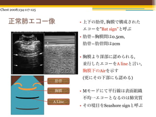 Chest 2008;134:117-125


    正常肺エコー像                       • 上下の肋骨, 胸膜で構成された
                                   エコーを”Bat sign”と呼ぶ
                                  • 肋骨―胸膜間は0.5cm,
                                   肋骨―肋骨間は2cm


                                  • 胸膜より深部に認められる,
                                   並行したエコーをA lineと言い,
                                   胸膜下のAirを示す
                                   (更にその下部にも認める)
                         肋骨

                         胸膜       • Mモードにて平行線は表面組織
                                   不均一エコーとなるのは肺実質
                         A Line
                                  • その境目をSeashore signと呼ぶ
 
