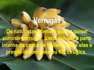 Verrugas Os naturistas afirmam que se quiser eliminar verrugas, basta colocar a parte interna da casca de banana sobre elas e prendê-la com gase ou fita cirúgica.   