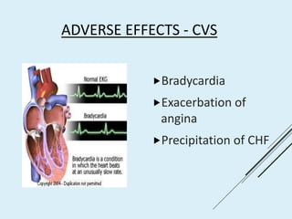 ADVERSE EFFECTS - CVS
Bradycardia
Exacerbation of
angina
Precipitation of CHF
 