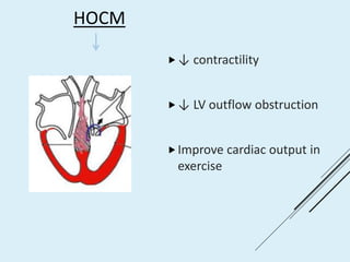 HOCM
↓ contractility
↓ LV outflow obstruction
Improve cardiac output in
exercise
 