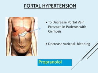 PORTAL HYPERTENSION
To Decrease Portal Vein
Pressure in Patients with
Cirrhosis
Decrease variceal bleeding
Propranolol
 