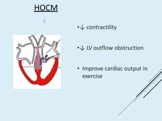 HOCM
•↓ contractility
•↓ LV outflow obstruction
• Improve cardiac output in
exercise
 