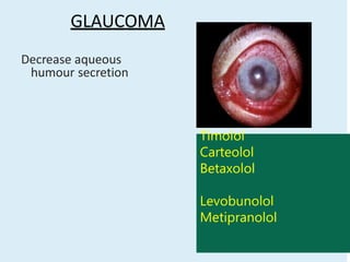 GLAUCOMA
Decrease aqueous
humour secretion
Timolol
Carteolol
Betaxolol
Levobunolol
Metipranolol
 