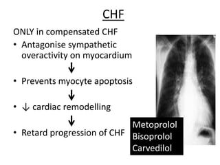 CHF
ONLY in compensated CHF
• Antagonise sympathetic
overactivity on myocardium
• Prevents myocyte apoptosis
• ↓ cardiac remodelling
• Retard progression of CHF
Metoprolol
Bisoprolol
Carvedilol
 