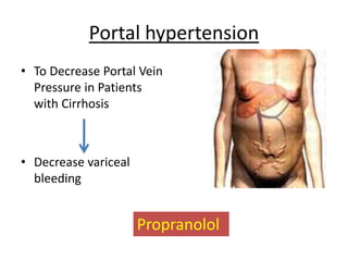 Portal hypertension
• To Decrease Portal Vein
Pressure in Patients
with Cirrhosis
• Decrease variceal
bleeding
Propranolol
 