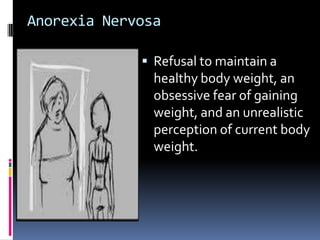 Anorexia Nervosa

              Refusal to maintain a
               healthy body weight, an
               obsessive fear of gaining
               weight, and an unrealistic
               perception of current body
               weight.
 