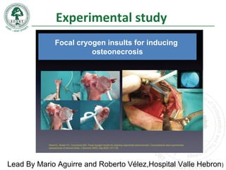 Experimental study
Focal cryogen insults for inducing
osteonecrosis
Lead By Mario Aguirre and Roberto Vélez,Hospital Valle Hebron)
 