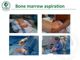 Bone marrow aspiration
 